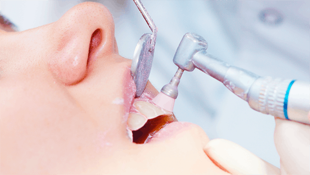 Limpieza dental en Medellín