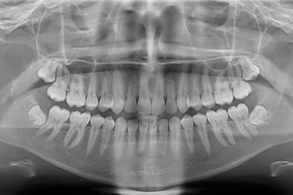 Los Rayos X en la odontología