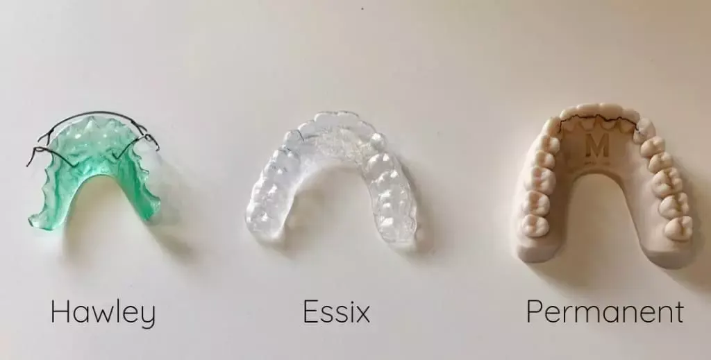Por que debo usar retenedores después de los brackets